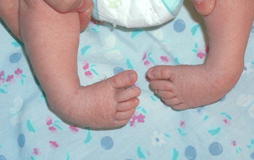 UP: छोटे बच्चों के टेढ़े पैरों का फ्री ट्रीटमेंट कर 500 बच्चों को दी नई जिंदगी, डॉक्टर नहीं, हैं ये यूपी के भगवान्