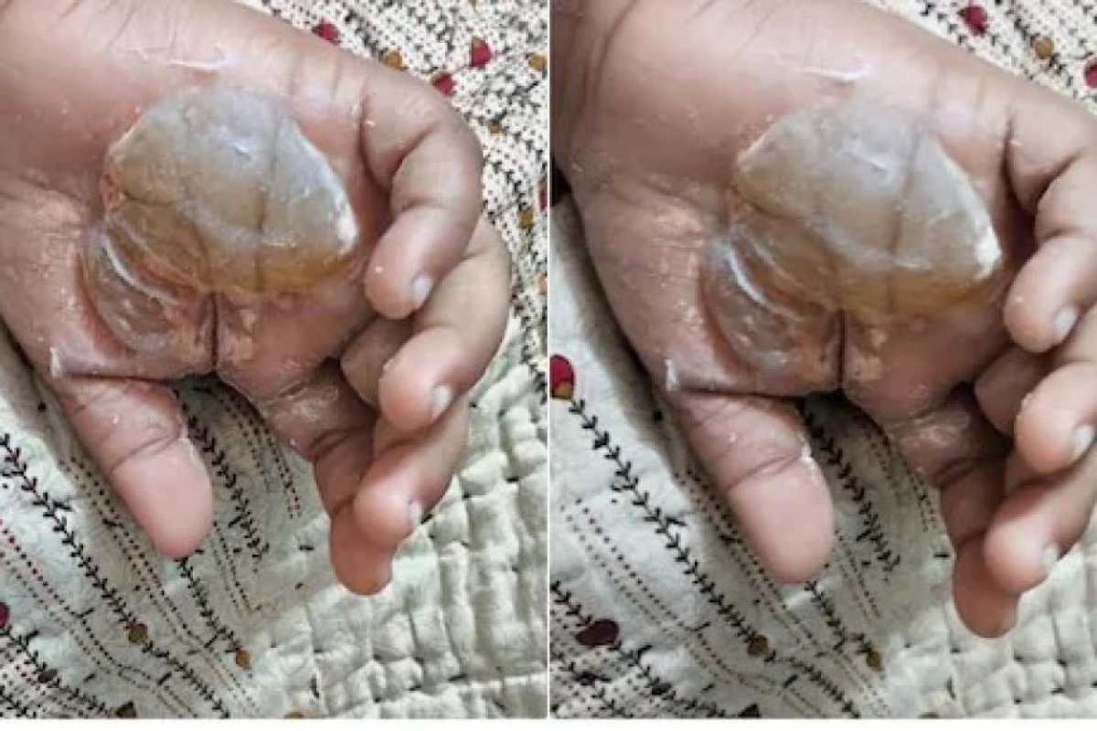 मुंबई के मलाड में ट्यूशन शिक्षिका ने 8 साल के बच्चे का हाथ जलाया, गिरफ्तार। 