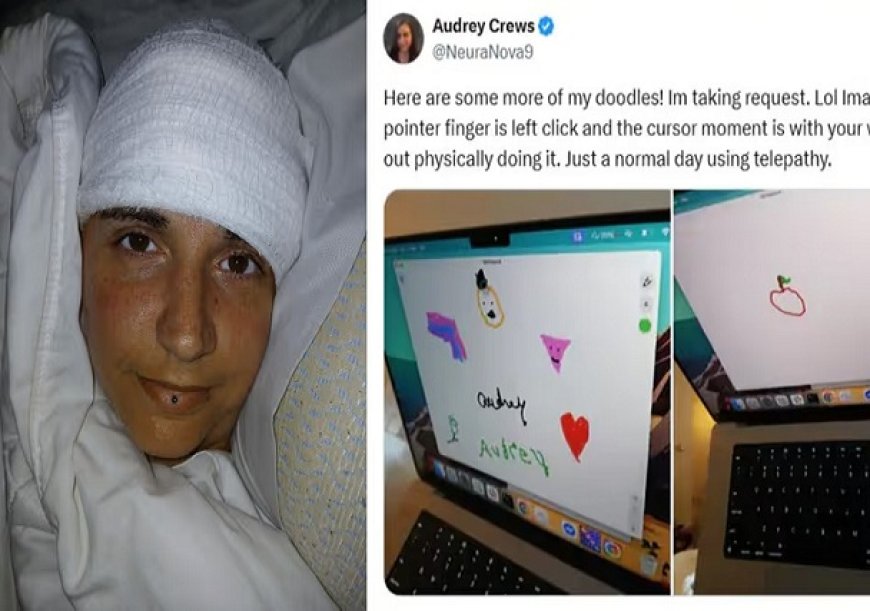 न्यूरालिंक की ब्रेन चिप- 20 साल से लकवाग्रस्त महिला ने सोचकर लिखा अपना नाम।