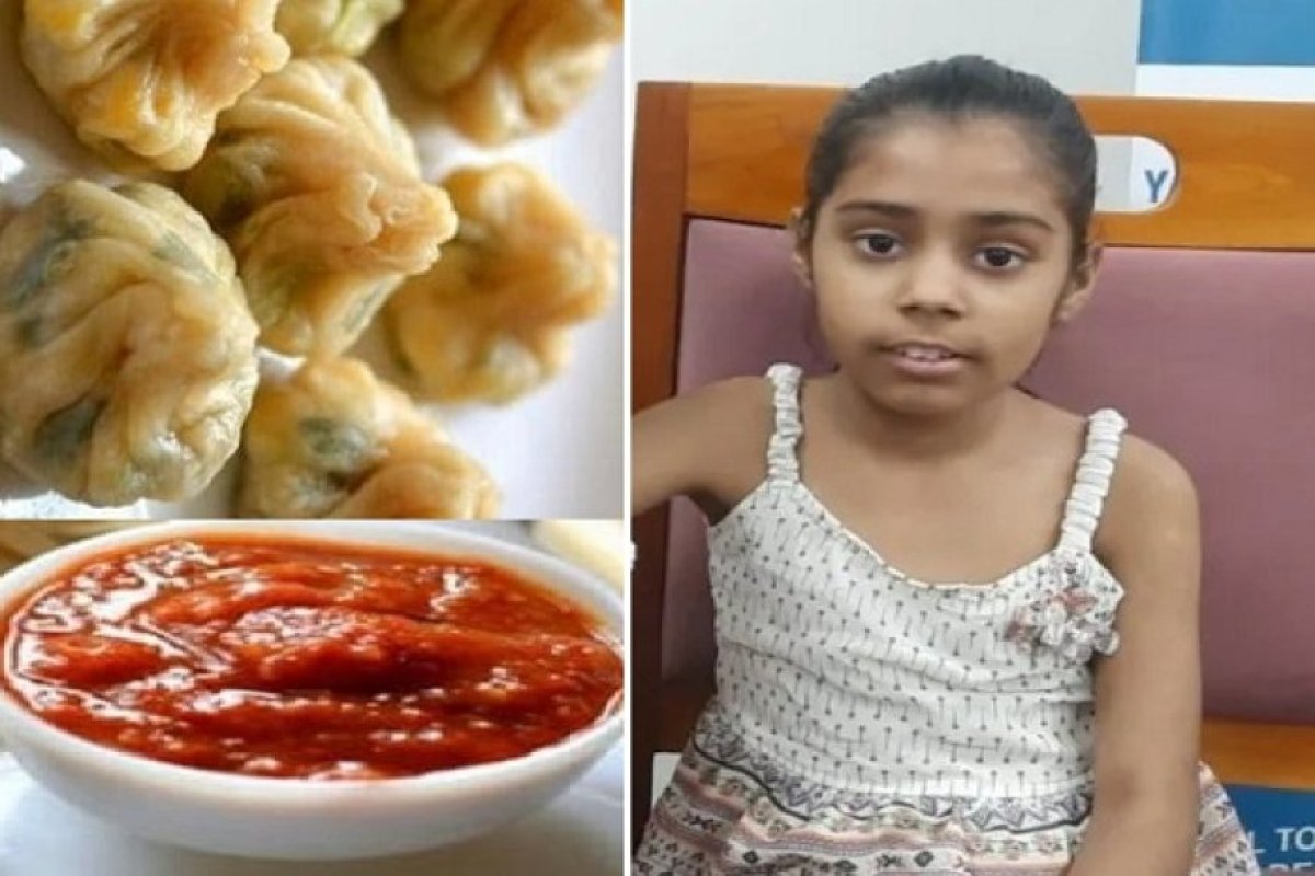 मोमोज खाने से 10 साल की मासूम का लिवर हुआ फेल: याददाश्त खोने और लकवे जैसी स्थिति के बाद डॉक्टरों ने किया चमत्कार।