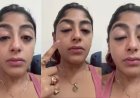 स्प्लिट्सविला 16 की कंटेस्टेंट प्रीत सिंह के साथ मुंबई क्लब में मारपीट, वीडियो शेयर कर दिखाया अपना टूटा दांत और सूजा चेहरा।