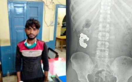 बरेली में शातिर चोर की गजब चालाकी, पुलिस को देखते ही निगल गया चांदी का ब्रेसलेट, फिर एक्सरे रिपोर्ट ने खोला राज।