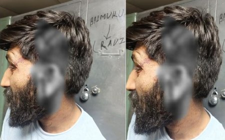 दिल्ली में मामूली बात पर खूनी संघर्ष: पेशाब करने के विवाद में दो युवकों को अधमरा होने तक पीटा, शरीर पर आए 35 टांके। 