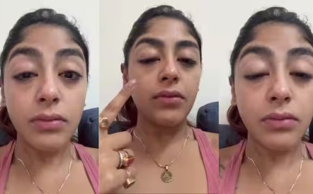 स्प्लिट्सविला 16 की कंटेस्टेंट प्रीत सिंह के साथ मुंबई क्लब में मारपीट, वीडियो शेयर कर दिखाया अपना टूटा दांत और सूजा चेहरा।