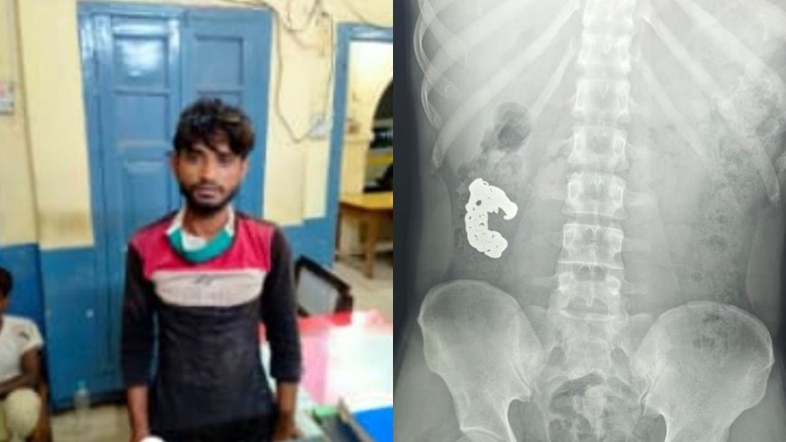 बरेली में शातिर चोर की गजब चालाकी, पुलिस को देखते ही निगल गया चांदी का ब्रेसलेट, फिर एक्सरे रिपोर्ट ने खोला राज।