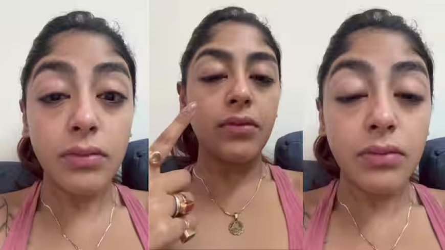 स्प्लिट्सविला 16 की कंटेस्टेंट प्रीत सिंह के साथ मुंबई क्लब में मारपीट, वीडियो शेयर कर दिखाया अपना टूटा दांत और सूजा चेहरा।