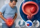 Bladder Cancer Symptoms: 60 की उम्र के बाद पुरुषों में ब्लैडर कैंसर का खतरा, यूरिन में खून आना मुख्य लक्षण, जानें बचाव